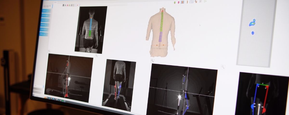 DIERS 4D biomechanical analysis — spine model and gait capture on screen