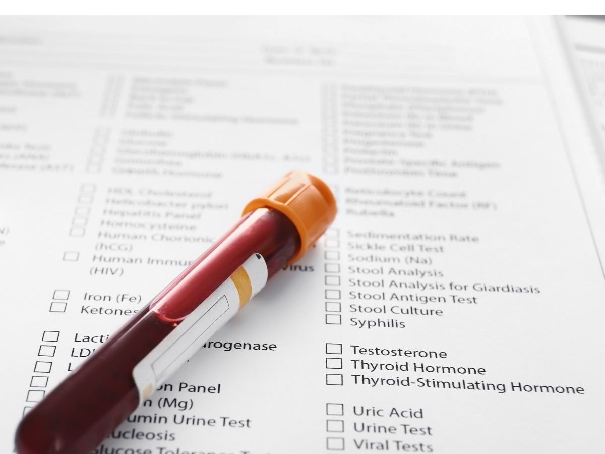 A blood sample vial on a biomarker test-order sheet