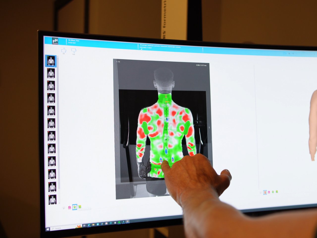 DIERS 4D gait capture — a spinal heat-map scan displayed on the lab monitor